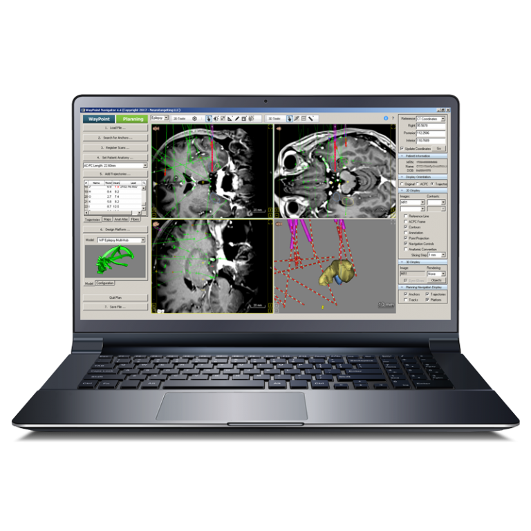 WayPoint™ Navigator Software FHC